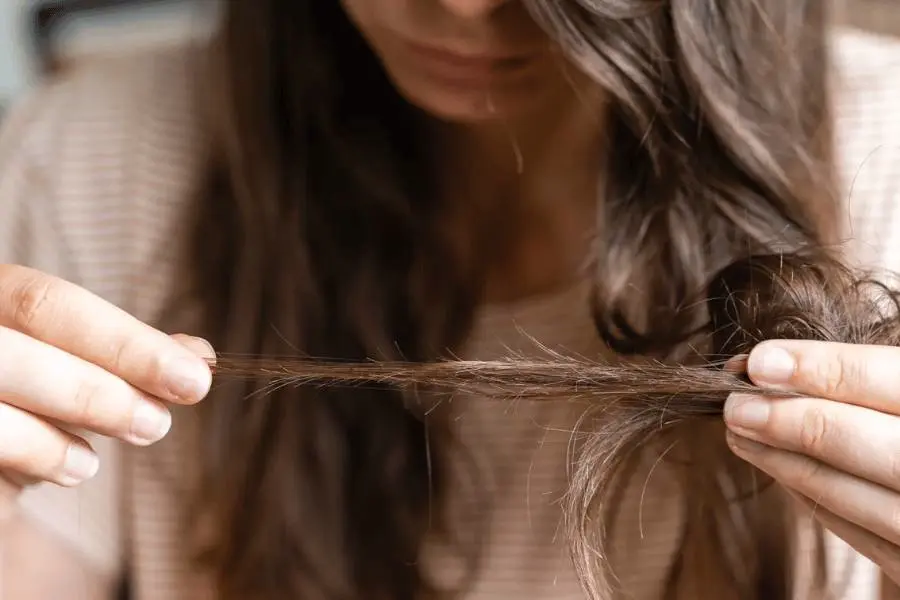 Alopecia areata en mujeres. Conoce toda la información sobre este problema capilar. 